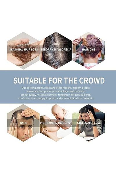 Sakura Japanese conditioner for Hair Growth, Preventing Hair Loss and Removing Dandruff 300ml
