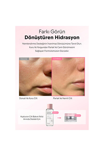 Hanskin Hyaluron Moisture Cream –hyaluron Nemlendirici Krem (tüm Cilt Tipleri Için Uygundur )[50 Ml]