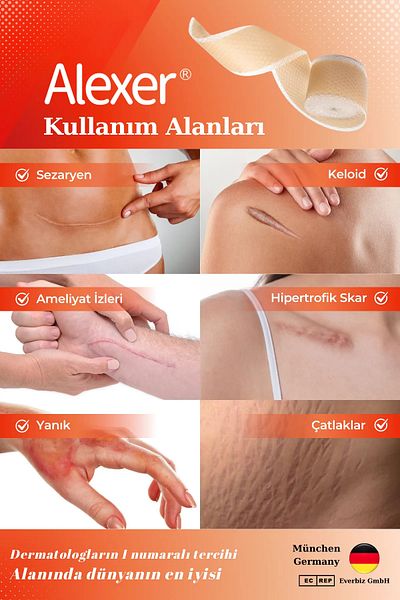 Alexer الندبات - شريط سيليكون ناعم، خياطة قيصرية، مزيل الندبات الجراحية بطول 2.5 سم × 3 متر