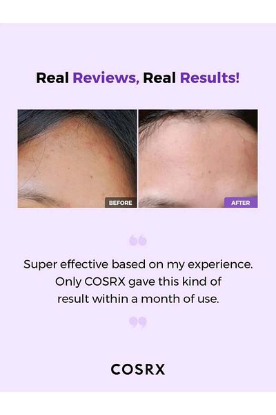Cosrx Toner exfoliant Aha/bha Clarifying Treatment Toner, 150ml