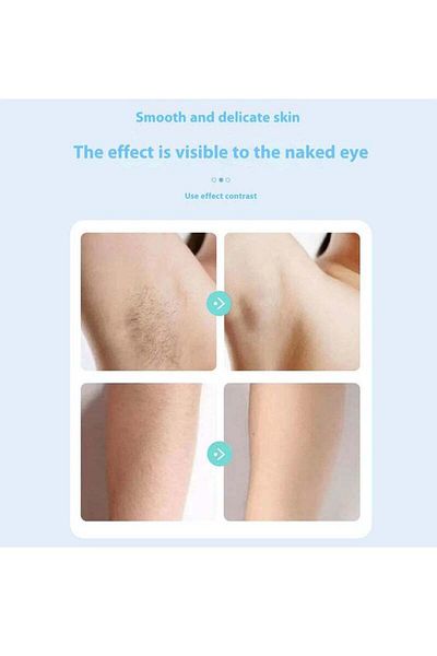 COOYA Epilator, Interchangeable Blades, Suitable for All Body Parts, Gentle on the Skin, Easy to Clean