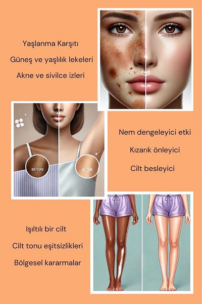 EDLIKE Natural Kojic Acid Soap Anti-Blemish Skin Care Soap