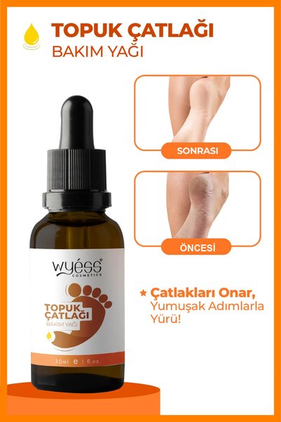Wyess New Effective Formula Foot and Heel Crack Care Oil Premium A-Quality 30 ml