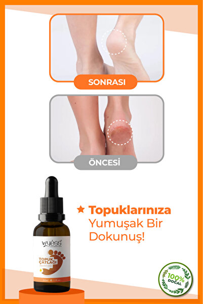 Wyess Ayak Ve Topuk Çatlağı Bakım Yağı 30 ml