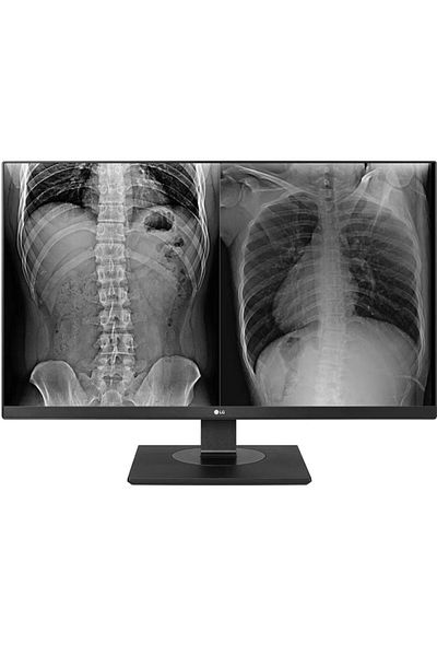 LG Monitor medical profesional IPS LED LG 27" 27HJ713C-B, UHD (3840 x 2160), HDMI, DisplayPort