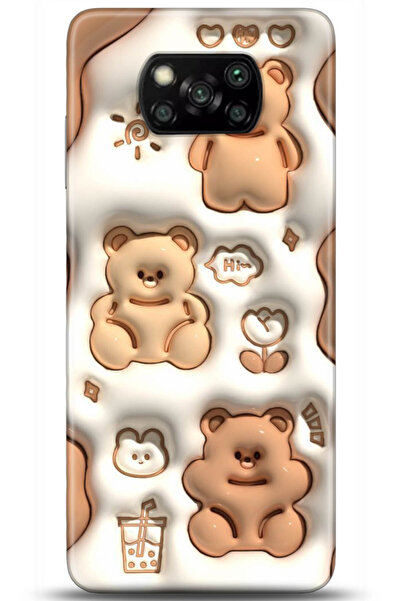 adveksiyon Xiaomi Poco X3 Pro Kılıf HD Baskılı Kılıf - Serenity Series 5047