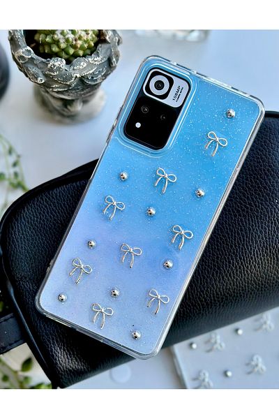 Go Aksesuar جراب سيليكون متوافق مع Redmi Note 11 - Note 11s بتصميم فيونكة صغيرة ثلاثية الأبعاد مع لعبة