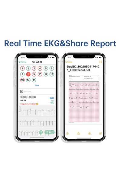 Choice Pocket Ecg Monitoring Device With Oled Screen Bluetooth Ekg Monitor For Rhythm Waveform, Free App...