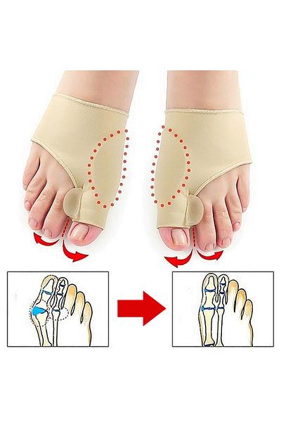 Choice 2 pairs Toe Corrector Orthotics Feet Foot Care Bone Thumb Adjuster Correction Soft Pedicure Socks Bu