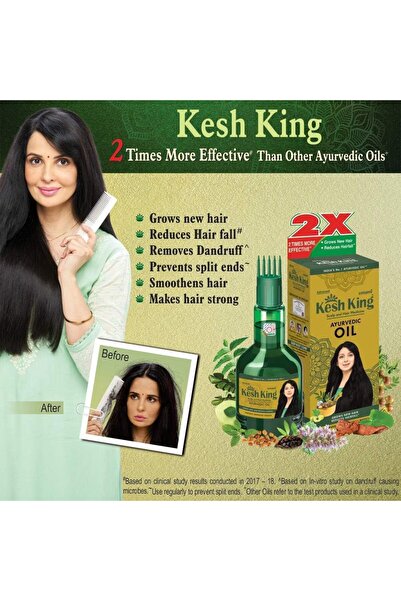 Emami زيت الشعر الأيورفيدي كيش كينج