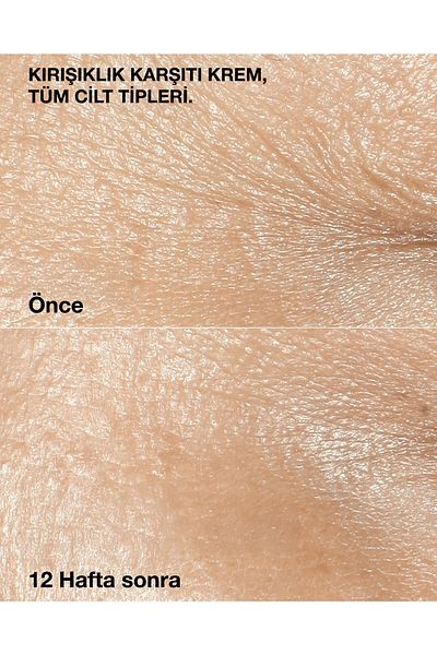 Clinique الإصلاح السريري الذكي ™   - كريم مضاد للخطوط والتجاعيد 15 مل |   حمض الهيالورونيك والببتيد
