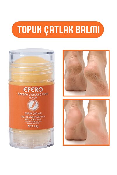 efero Kuru Ve Yıpranmış Ayaklar & Topuklar İçin Ayak Ve Topuk Kremi 40g