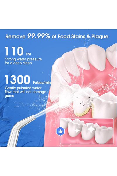 Youtrico 2PCS water flosser accessories (only applicable to Youtrico, H2ofloss brand flossers)