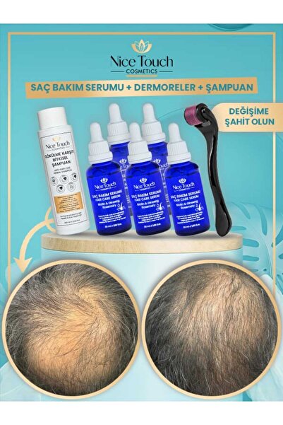 Nice touch 5 Adet Saç Bakım Serumu Dökülme Karşıtı Şampuan Dermoroller Saç Cı...