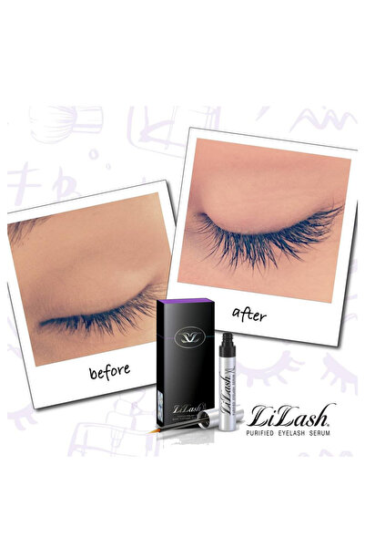 Lilash Beauty Xl Eyelash Serum – Advanced Lash Serum For Longer, Fuller Eyelashes - 4ml