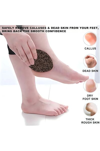 Choice 1PC Pumice Stone , Scrubber Stone Pedicure Tools Natural Foot Scrubber for Exfoliation to Clear C...
