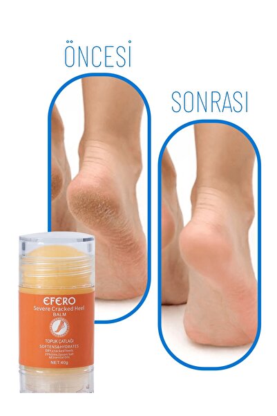 efero Kuru Ve Yıpranmış Ayaklar & Topuklar İçin Ayak Ve Topuk Kremi 40g