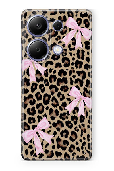 moonset Xiaomi Redmi Note 13 Pro 4G Uyumlu Leopar ve Fiyonk Tasarımlı Baskılı...