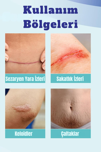 Aroamas Silikon Yara Jeli – Keloid, Ameliyat, Yanık Ve Yaralanma Izleri Için Tıbbi Kalitede Jel