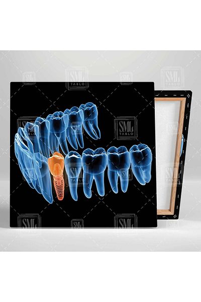 SML TABLO Dentist Dental Office Rose Design Dentist Square Canvas Painting