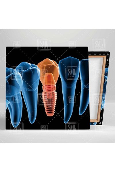 SML TABLO Sănătatea gurii și a dinților Dentist Dental Treatment Office Square Canvas Painting