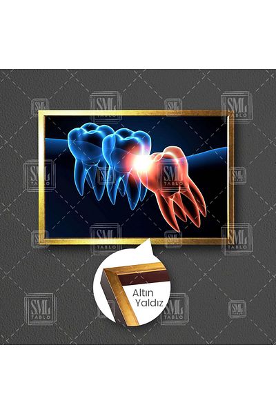 SML TABLO Oral Dental Health Dentist Dentist 20' Framed Horizontal Canvas Painting