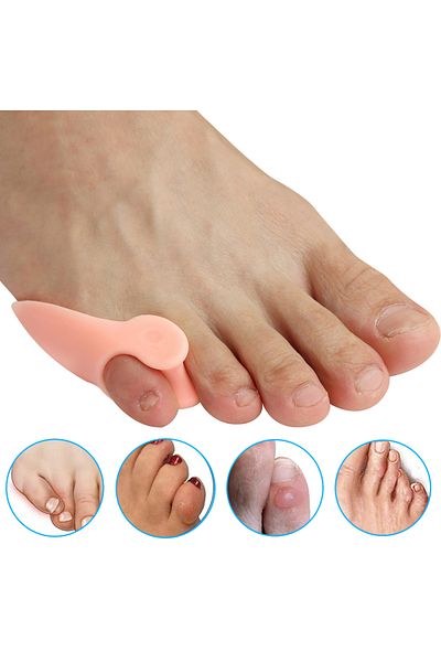 Choice Beige-2pcs Pexmen 2/4pcs Gel Pinky Bunion Corrector Toe Separators Bunionette Pads Toe Spacers For P