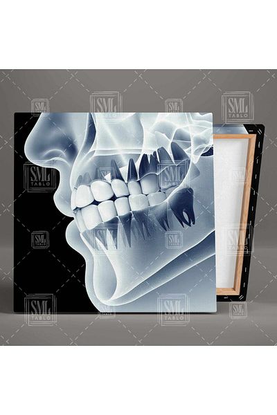 SML TABLO Sănătatea dinților Dentist Dentist Chin X-Ray Dentist Square Canvas Painting