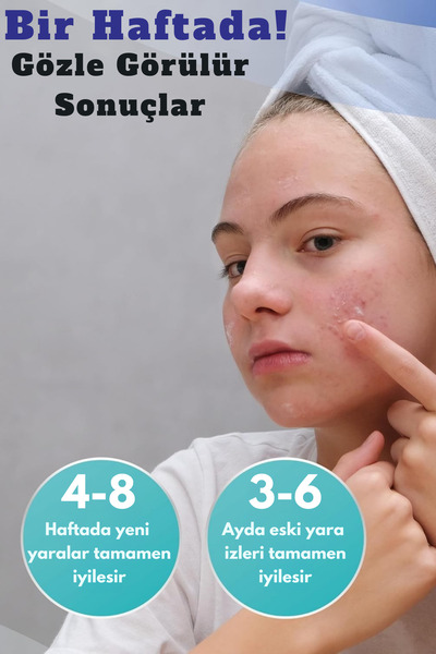 Aroamas Silikon Yara Jeli – Keloid, Ameliyat, Yanık Ve Yaralanma Izleri Için Tıbbi Kalitede Jel