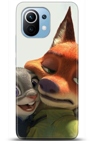 Noprin Xiaomi Mi 11 Case Hd Printed Case - Custody Series 5115