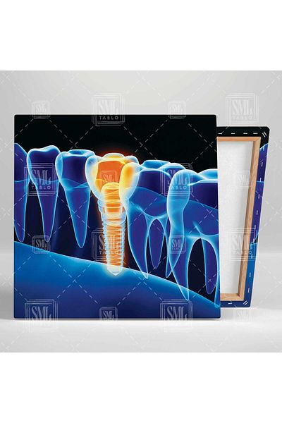 SML TABLO Dentist Dental Office Sănătatea bucală și a dinților Dentist Square Canvas Painting