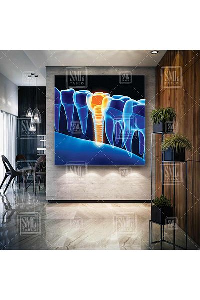 SML TABLO Dentist Dental Office Sănătatea bucală și a dinților Dentist Square Canvas Painting