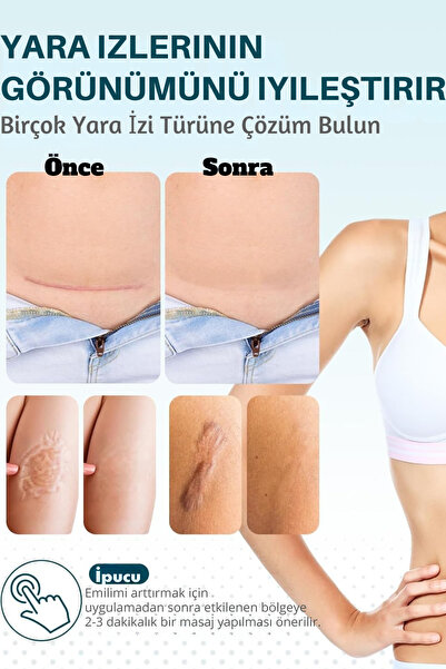 T&H Gelişmiş Yara Izi Jeli. Yara Kremi, Anti-yara Izi, Yara Izi Giderici, Medikal Silikon Ve Kolajen