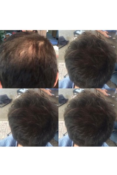 Trixowell Advanced Hair Vitamin Biotin, Vitamin, Mineral Herbal Extract, Saw Palmetto, Zinc, Iron, B5, B6 3 Boxes