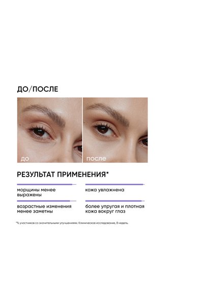Icon Skin Age Eraser Anti-Aging Eye Contour Care Cream with 0.05% Retinol 20 ml