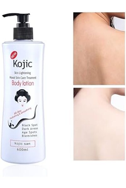 RDA لوشن كوجيك لتبييض البشرة من RDA