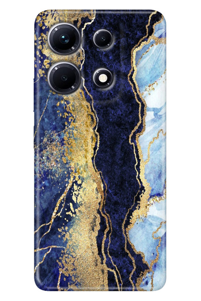 casetube Infinix Note 30 Case Patterned Printed Flexible Silicone Cover Hillm...