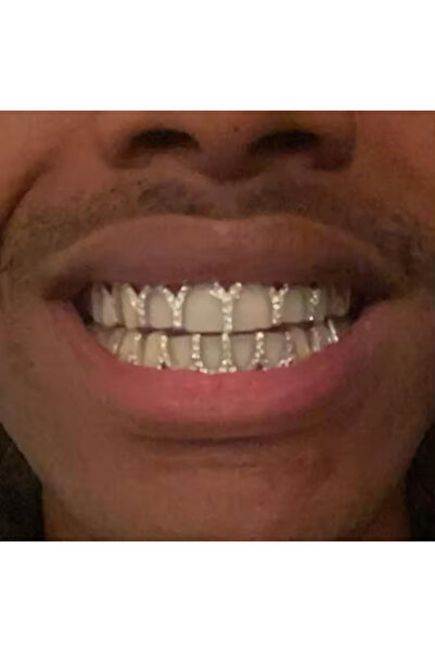 Zümrüt OyuncakStore Gold Rengi Y2k Hip Hop Grillz Alt ve Üst İkili Full Taşlı Tooth Gems Diş Taşı Aksesuarı