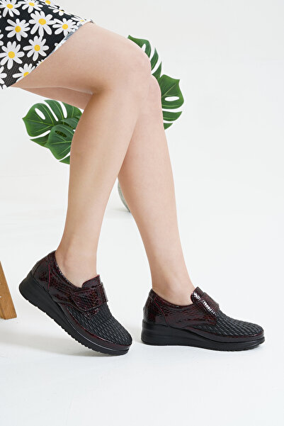 MİRATERLİK ORTOPEDİK TERLİK VE AYAKKABI Mira Orthopedic Leather Shoes Suitable for Heel Spurs, Bone Protrusions and Scalloped Feet