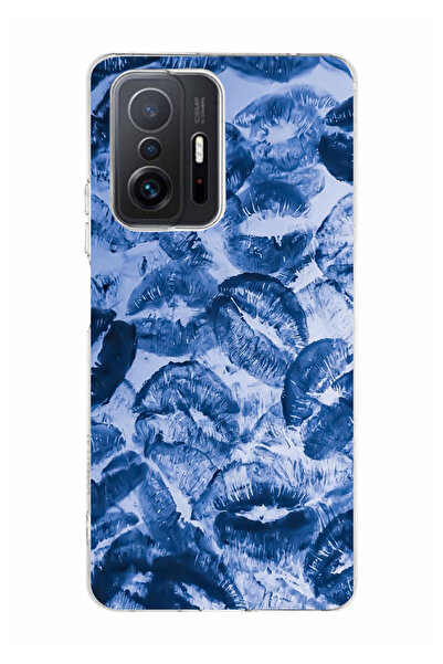 moonset Xiaomi Mi 11T / Mi 11T Pro Uyumlu Mavi Dudaklar Tasarımlı Baskılı Şef...