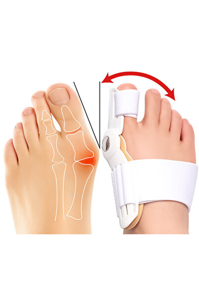 Manor Baş Parmak Kemik Düzeltici Ayak Baş Parmak Gömleği Kemik Bunyon Düzeltici Parmak Ayırıcı Halluks