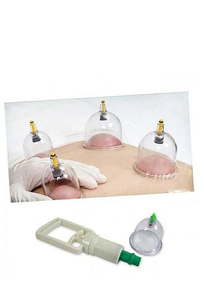 Skygo Cupping Set - Vacuum Mug Set (Model 1)
