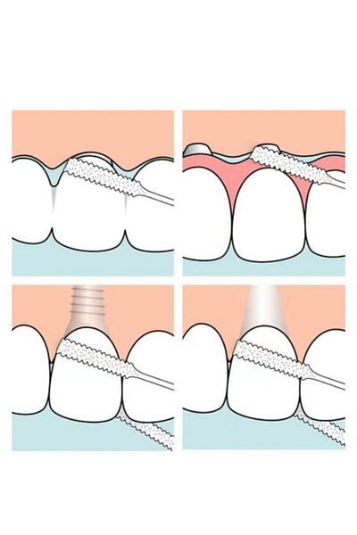 TePe Wide waxed dental floss for implants and orthodontics