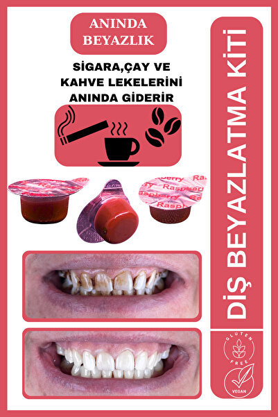 AVANT DENTAL SUPPLY 3 Tüp Diş Beyazlatıcı Ahududu Aromalı Sigara Çay Kahve Le...