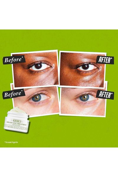 Kiehl's Creamy Eye Treatment with Avocado White 14grams