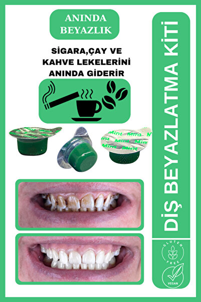 AVANT DENTAL SUPPLY 3 Tüp Diş Beyazlatıcı Nane Aromalı Sigara Çay Kahve Lekes...