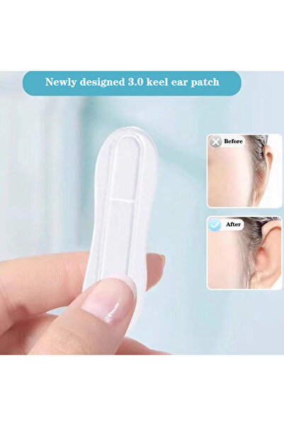 Choice 18 Pieces Cosmetic Ear Corrector Elf Ear Stickers Ear Supporters Self ...