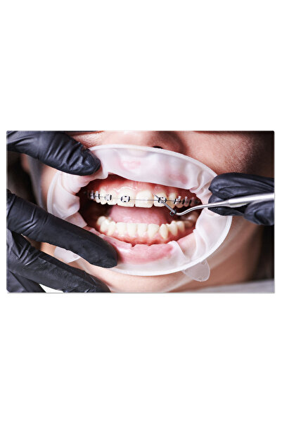 StoryGift Romania Tablou Canvas: Zambet Perfect - Ortodontie, Aparate Dentare...