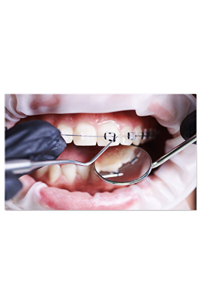 StoryGift Romania Tablou Canvas: Specialist Ortodont - Tratament, Dantura Per...