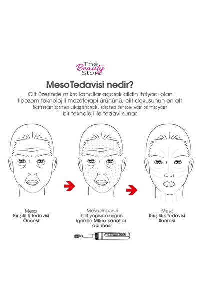 TheBeautyStore İğneli Mezoterapi Tabancası Cilt Gençleştirme Saç Mezo Yüz Kırışıklık Leke Çizgi Giderme Cihazı